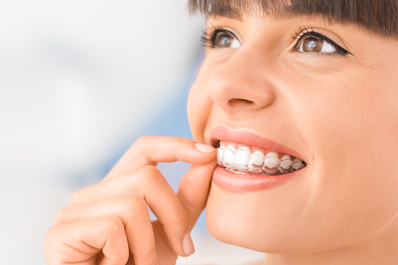 Invisalign in Joplin